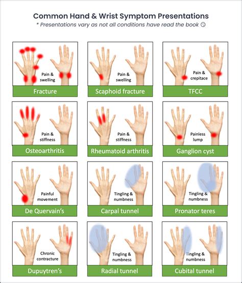 Evaluation of Hand